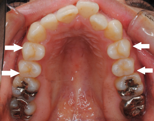 舌と呼吸の密接な関係 呼吸はどのように歯並びと関わっている 長津田 青葉台の歯列矯正 長津田アオバ矯正歯科